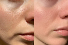 Before and after comparison of a person's lips.